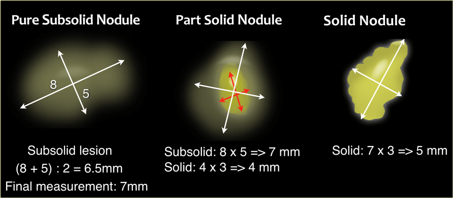 A lesion which measures 8 x 5 mm has an average of (8 + 5) : 2 = 6.5 mm - rounded up to 7 mm