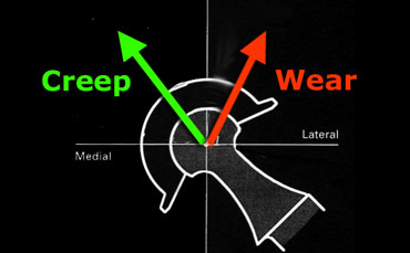 Creep is normal remoulding and is superomedial. Wear is superolateral and pathologic