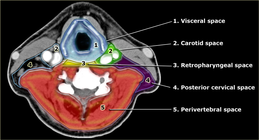 Spaces defined by the deep cervical fascia