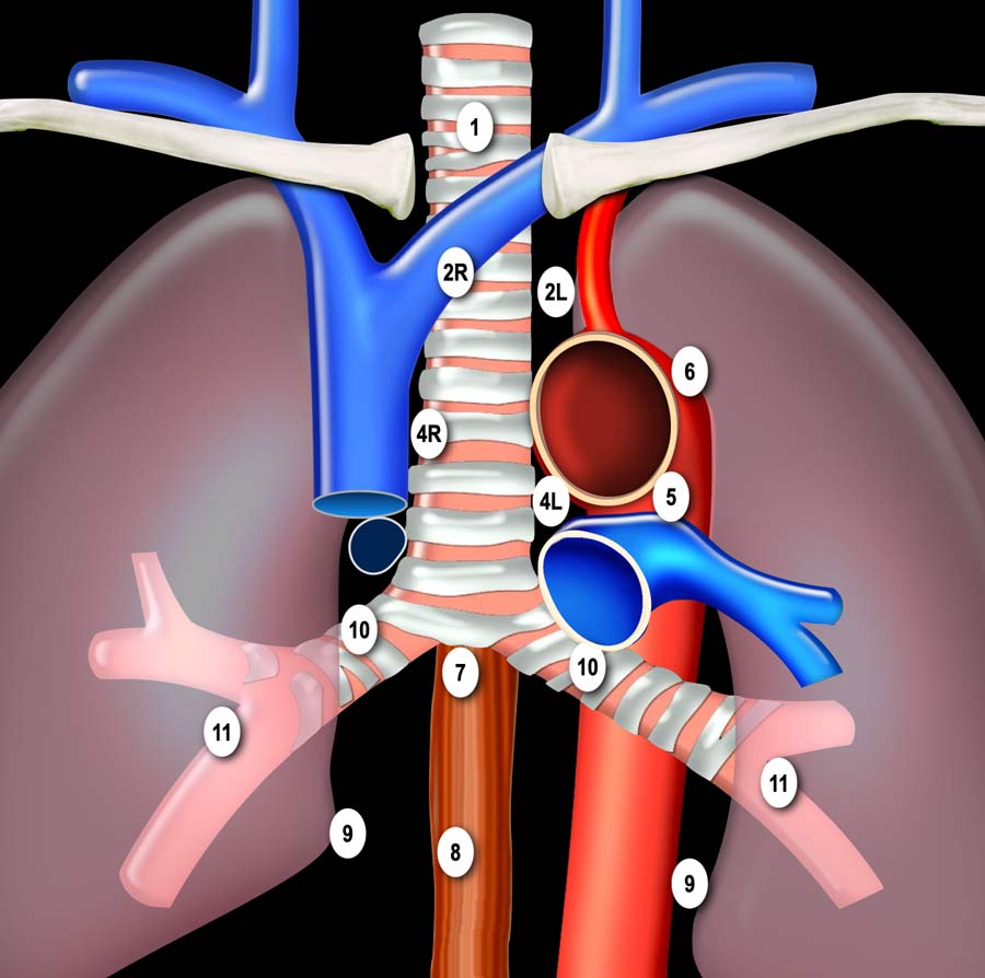 Adapted from the American Thoracic Society mapping scheme