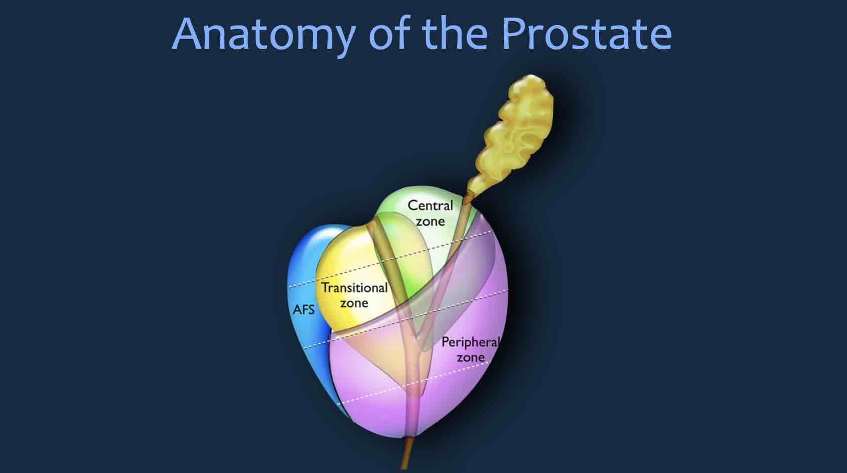 The Radiology Assistant : Lectures