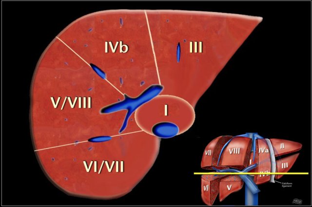 New liver anatomy―Portal segmentation New Liver Anatomy: Portal Segmentation and the Drainage Vein