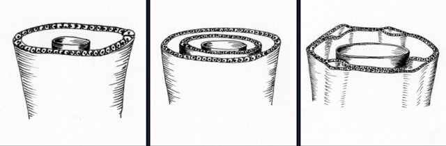 Normal development of the ductal plate (Illustration by Aletta Frazier)