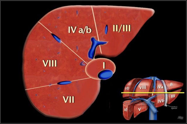 Image at the level of the left portal vein.