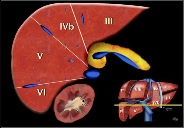 Image at the level of the splenic vein.