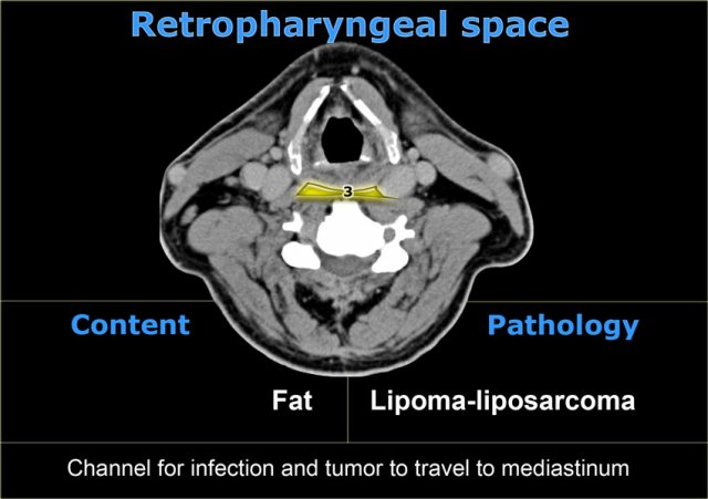 Retropharyngeal space