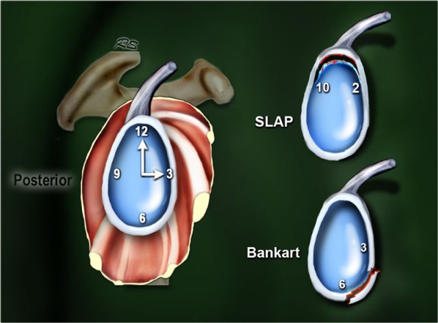 Clockwise approach. Click on image to enlarge