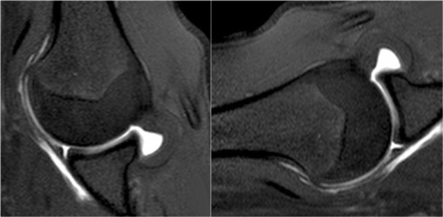 LEFT: normal ABER-view. RIGHT: Image rotated 90? anti-clockwise.